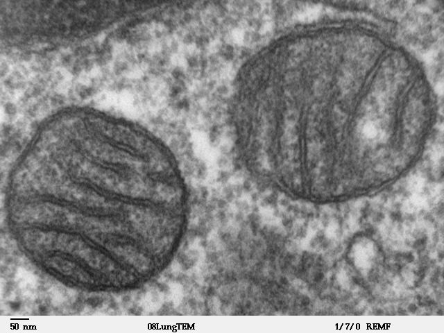 Transmission electron micrograph of mitochondria in mammalian lung tissue
